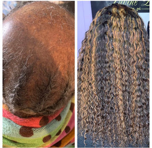 The Foundation of Hair Replacement: Medical Wig Making & Insurance/Veteran Benefits Training (Houston, Tx June 22-24th)