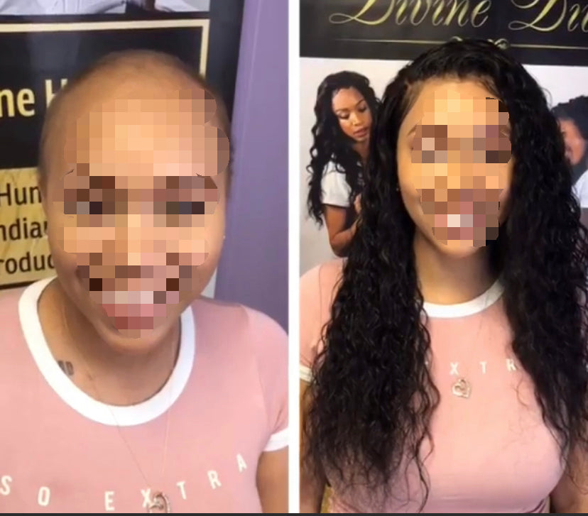 Hands on Hair Loss: Medical Wig & Insurance/Veteran Benefits Training (Houston August 9-10th)