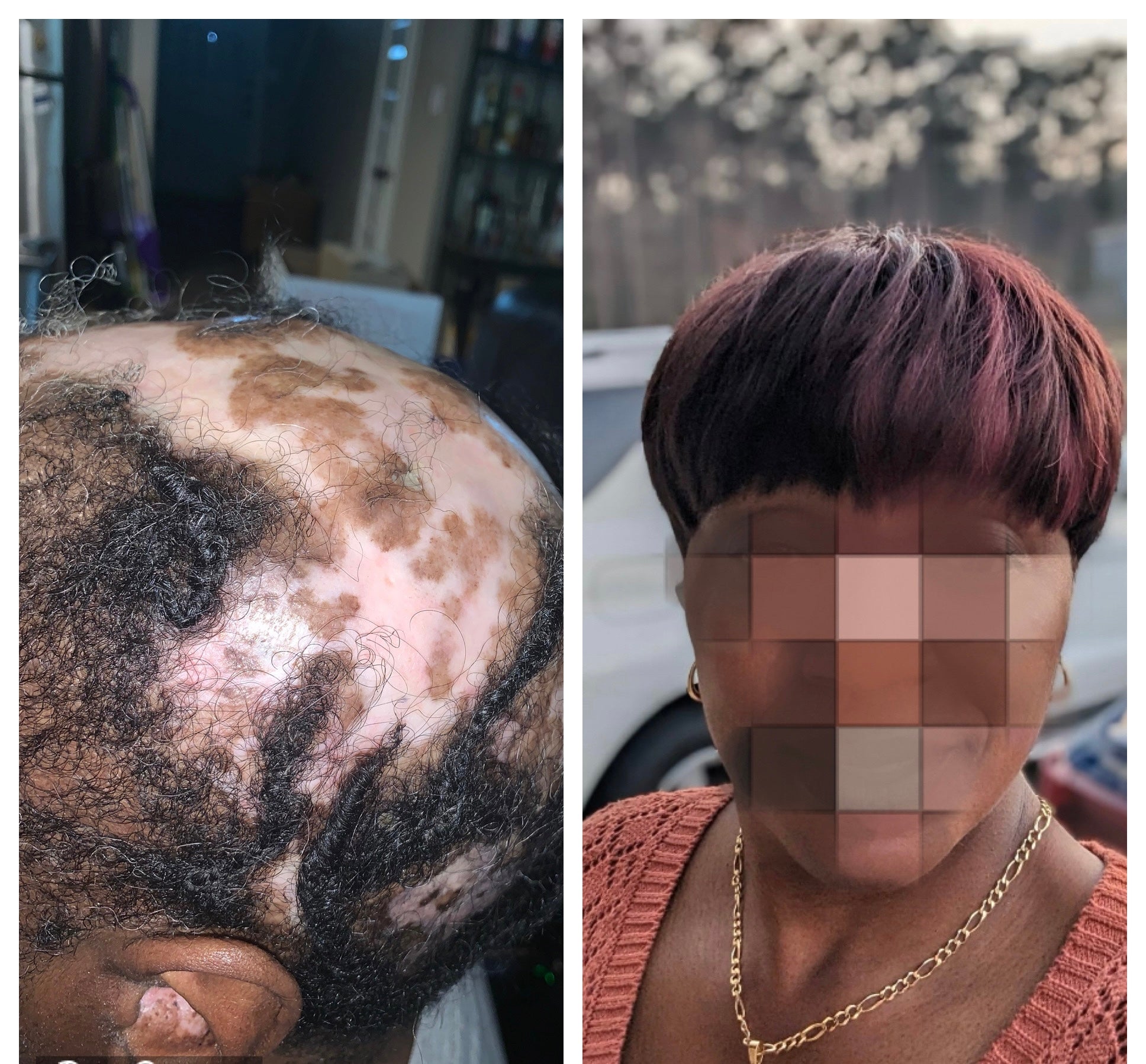 Hands on Hair Loss: Medical Wig & Insurance/Veteran Benefits Training (Houston August 9-10th)