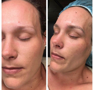 Dallas Blade to Shade: Microblading & Microshading Training 6/24-6/25
